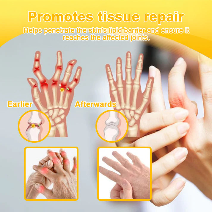 ✨Official Flagship Store✨Alcuras® Botulinum Toxin & Bee Venom Pain-Relief Bone Healing Cream