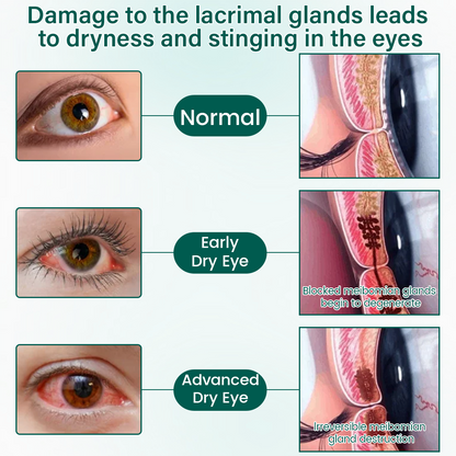 Alcuras® OptiClear Nano Eye Roller Serum
