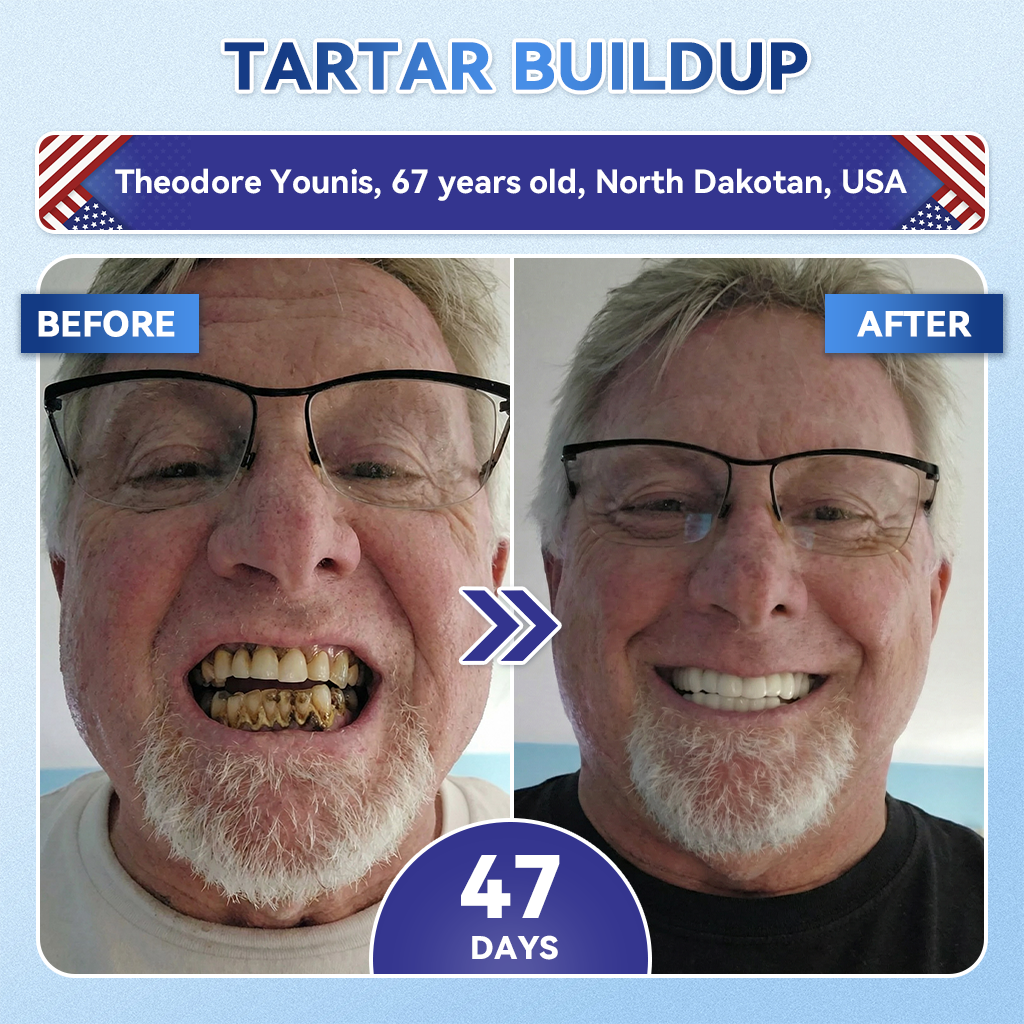 Alcuras® 🦷Fast‑Dissolving Tooth & Gum Repair Oral Strips ✨