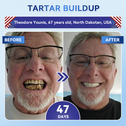 Alcuras® 🦷Fast‑Dissolving Tooth & Gum Repair Oral Strips ✨
