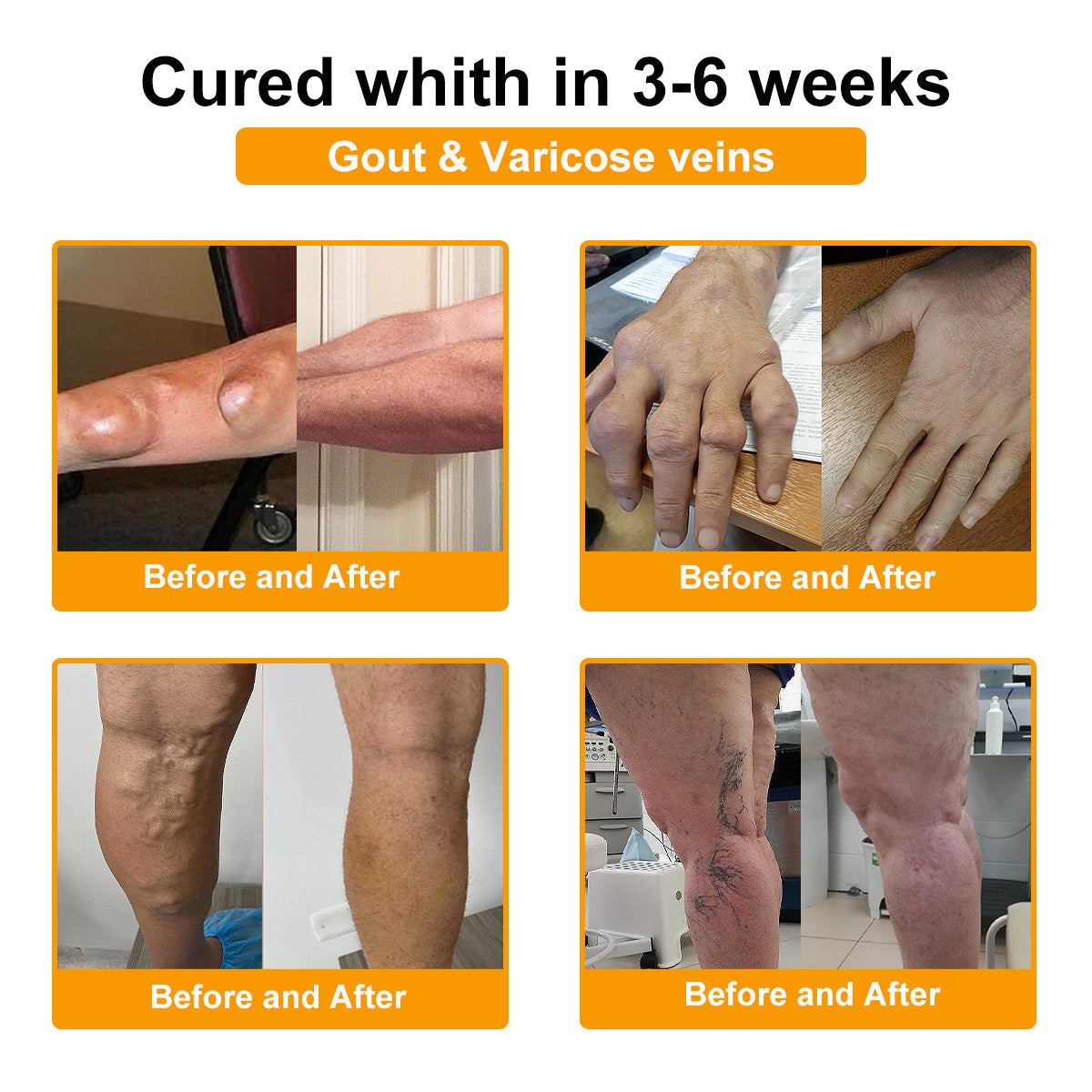 ✨Official Flagship Store✨Alcuras® Botulinum Toxin & Bee Venom Pain-Relief Bone Healing Cream