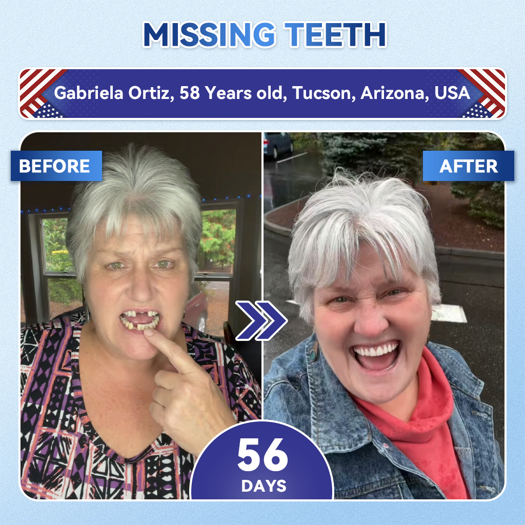 Alcuras® 🦷Fast‑Dissolving Tooth & Gum Repair Oral Strips ✨