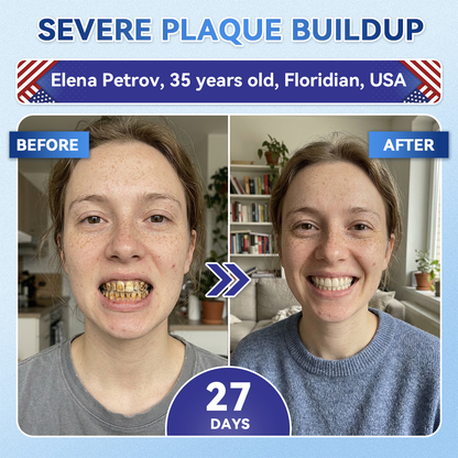 Alcuras® 🦷Fast‑Dissolving Tooth & Gum Repair Oral Strips ✨