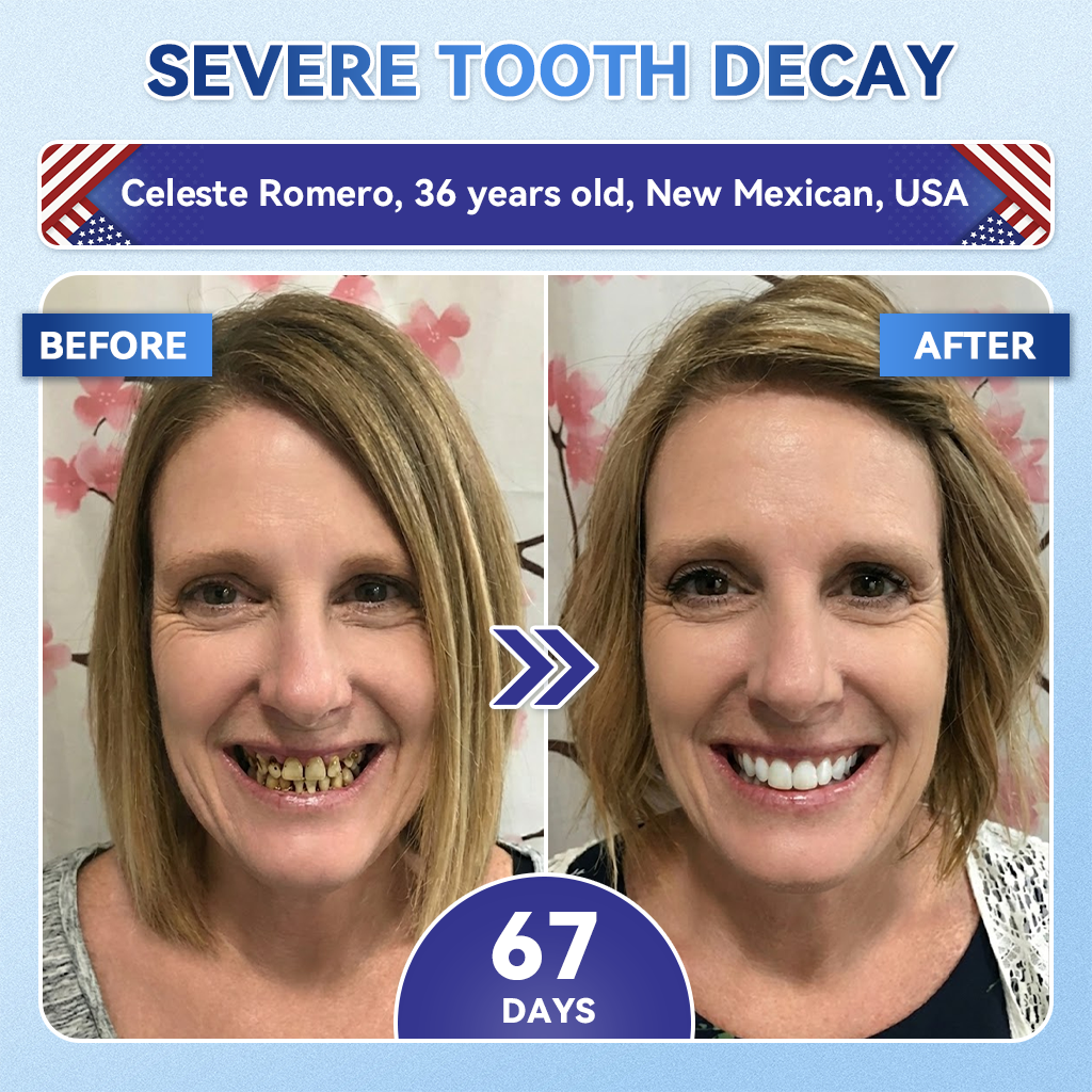 Alcuras® 🦷Fast‑Dissolving Tooth & Gum Repair Oral Strips ✨