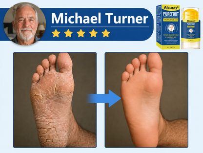 Last Day 49% OFF🔥Alcuras® Pure Foot Diabetes Treatment Stick