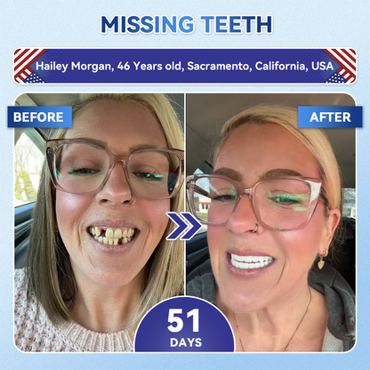 Alcuras® 🦷Fast‑Dissolving Tooth & Gum Repair Oral Strips ✨