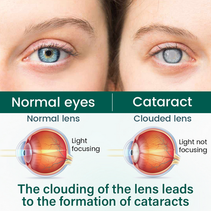 Alcuras® OptiClear Nano Eye Roller Serum