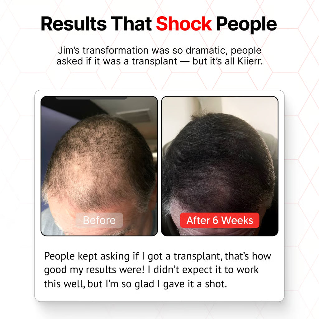 🧑‍⚕️Red Light Therapy Hair Growth Cap🧢(Results were seen in as little as 6–8 weeks)