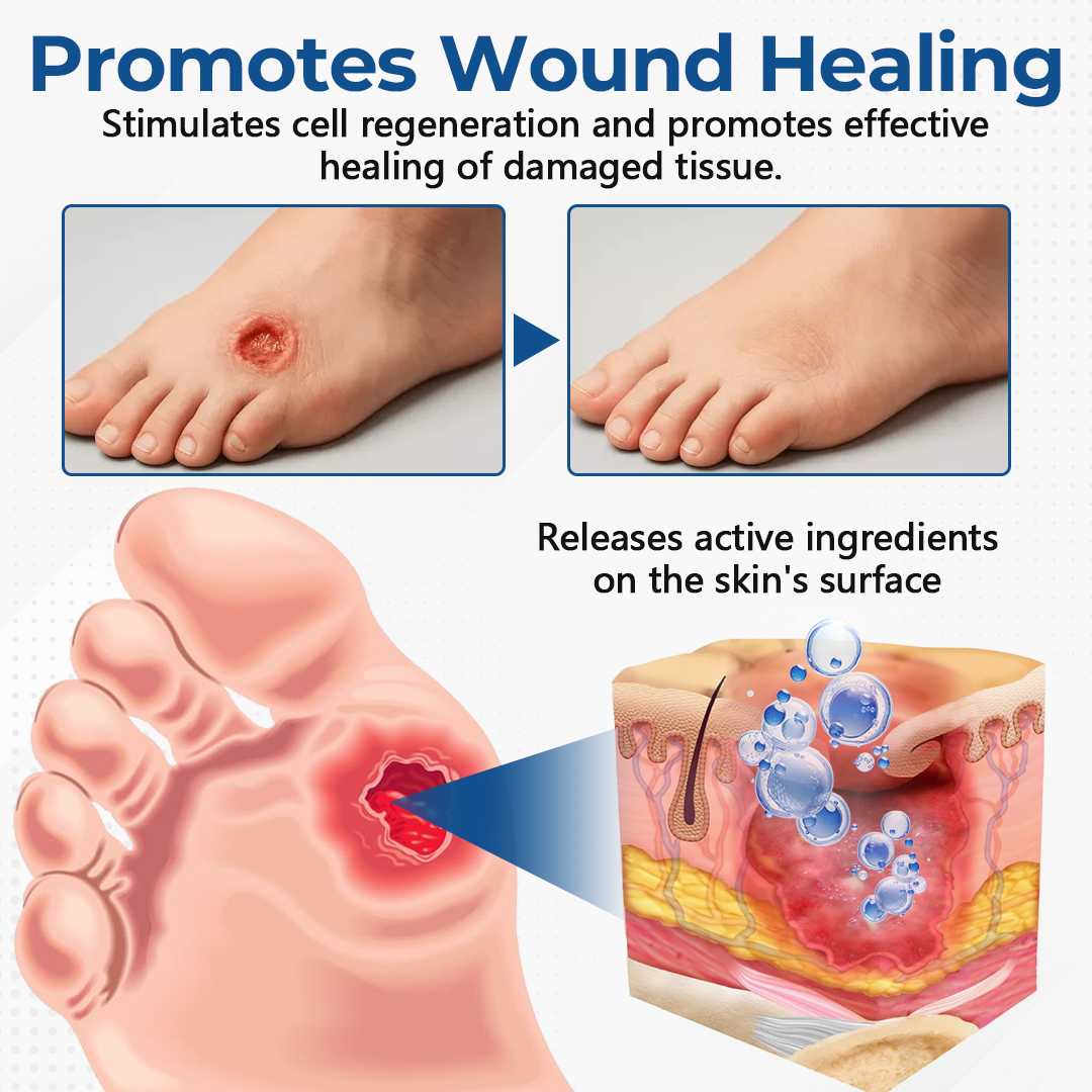 Last Day 49% OFF🔥Alcuras® Pure Foot Diabetes Treatment Stick