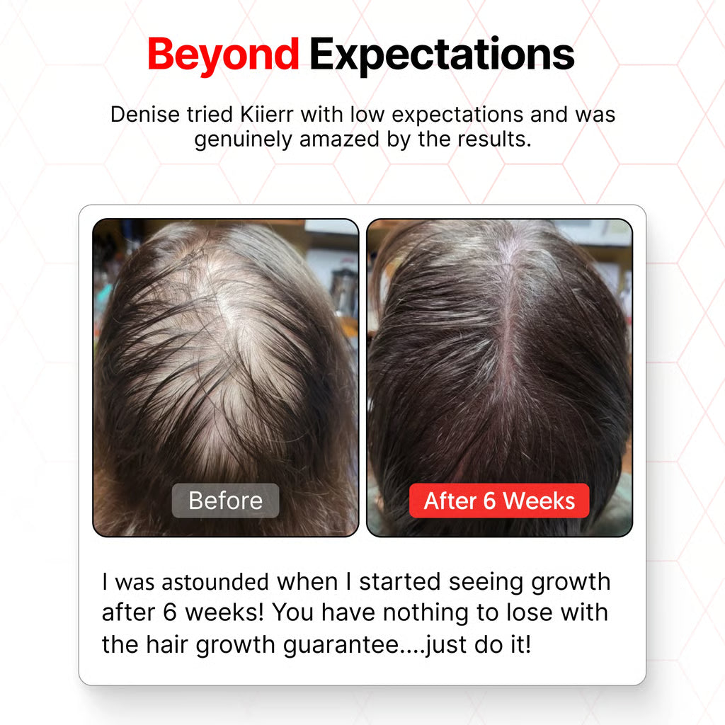 🧑‍⚕️Red Light Therapy Hair Growth Cap🧢(Results were seen in as little as 6–8 weeks)