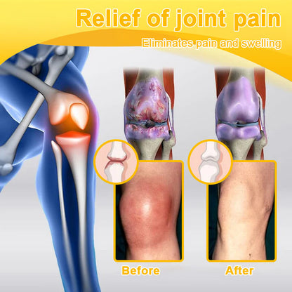 ✨Official Flagship Store✨Alcuras® Botulinum Toxin & Bee Venom Pain-Relief Bone Healing Cream
