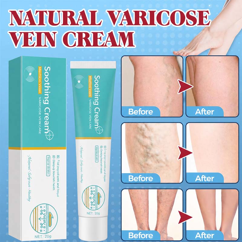 Alcuras® Herbal Varicose Veins Cream, Leg Relief Care🦵