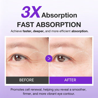 ✨BUY 1 GET 1 FREE✨Instantly Lift Eye Gel - For Puffiness & Bags, Wrinkles, Fine Lines and Dark Circles