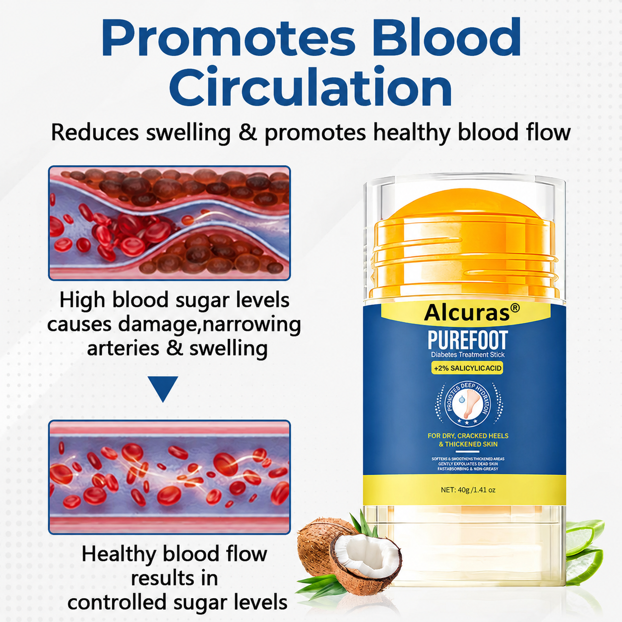 Last Day 49% OFF🔥Alcuras® Pure Foot Diabetes Treatment Stick
